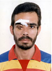 apoio_picture2